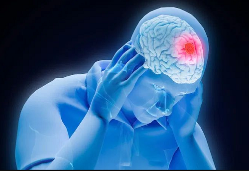 Best Stroke Intervention Specialist in Chembur